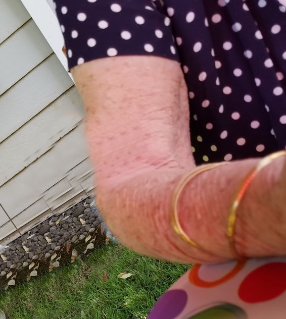 Mom's arm with gold bracelets